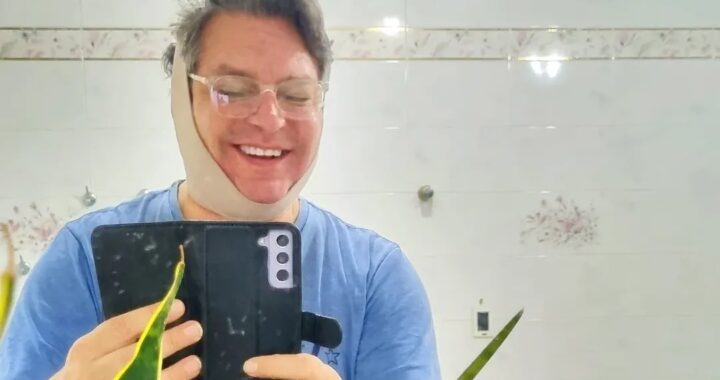 Mili Brítez se renueva: “Me hice lipo en la papada, ¿y qué?”