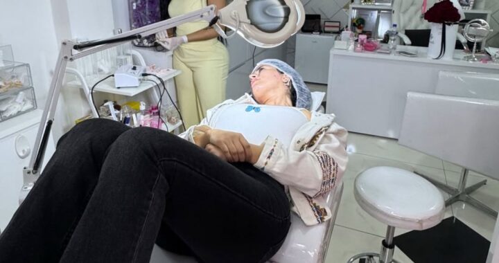 Se quitó los lunares “para verse más linda”, la decisión de Mily Brítez